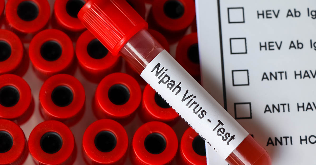 El mortal virus Nipah: ¿de dónde proviene y cómo se transmite? 
