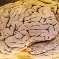 Un cerebro humano