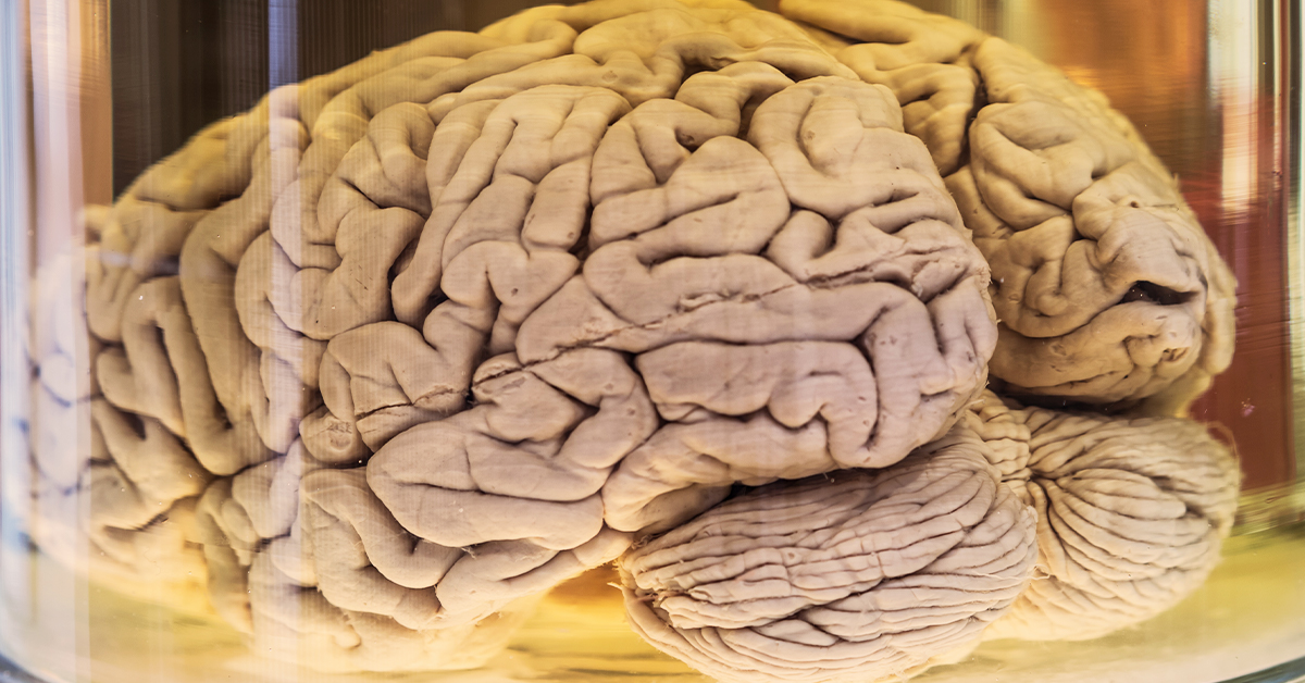 Un cerebro humano