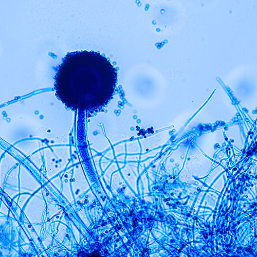 Hongos aspergillus niger, capaces de soportar la radiación. 