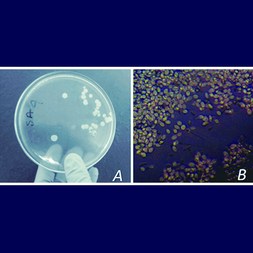 Cryptococcus neoformans